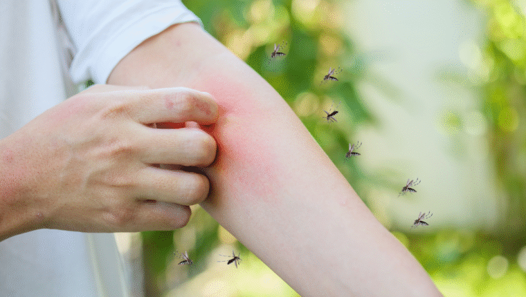 Se puzzi attiri le zanzare: ecco quali saponi usare per allontanarle - immagine di copertina