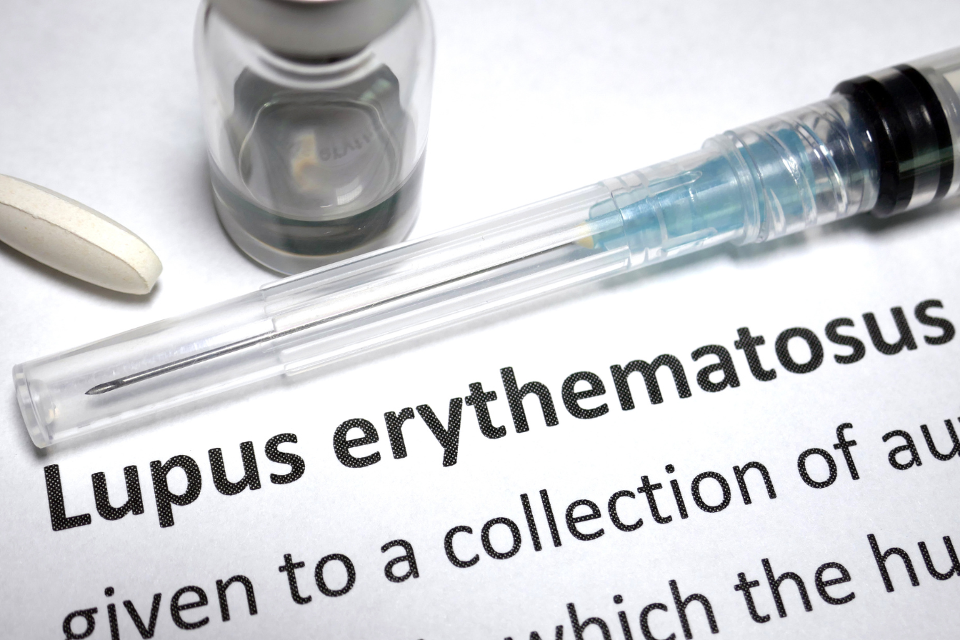 lupus